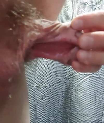 Pee with subincision penis is messy