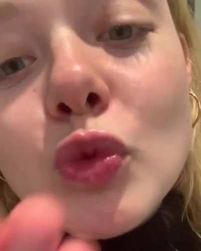 Kiss