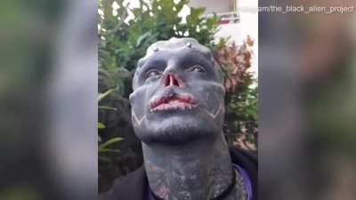 A man wanted to become a 'black alien' so he had his nose and top lip removed