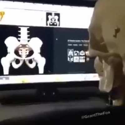 Osbir &ccedil;eken iskelet deep web#1