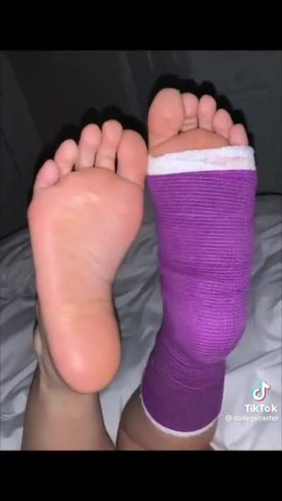 collegecaster - Gorgeous soles!! I think I may have unlocked a new kink &ldquo;Cast Fetish&rdquo; hahaha