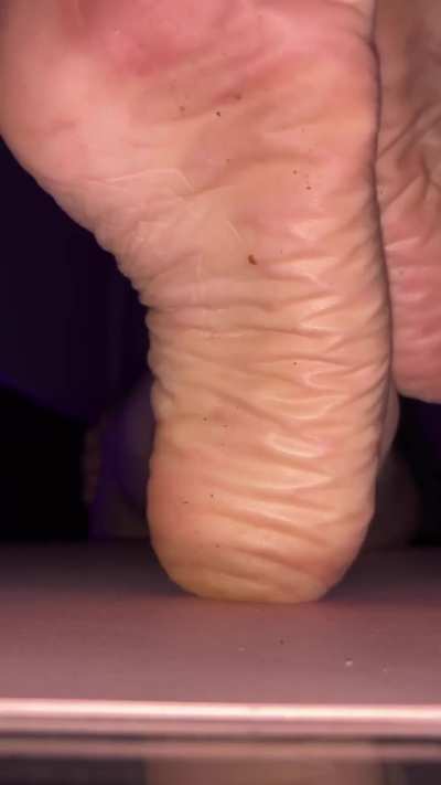 Wrinkless😍