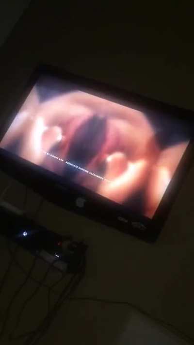 Nor ever goo... I know thats the worse thing u will see today
