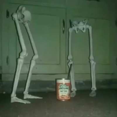 Legs