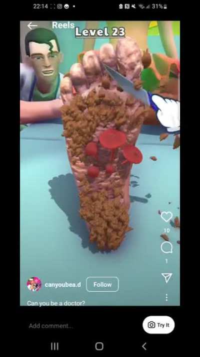 🤢🤢