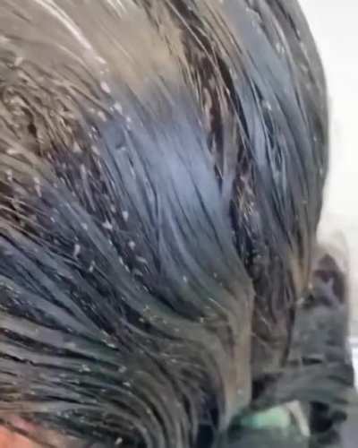 It's lice to meet you!