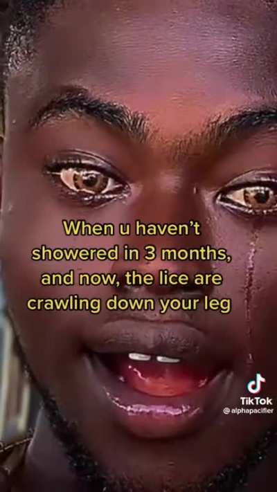 OMG WHAT 💀