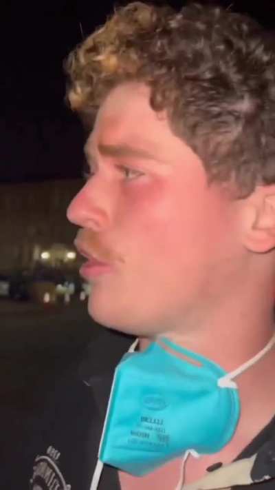 May 1 2024 - UCLA student describes Zionist counter-protestors attacking him, saying, “They threw a rock at my eye, they threw a hammer at my leg, they slashed my arm, and then they pepper sprayed me in the eyes.”