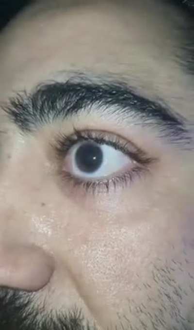 Took some pretty shady MDMA this weekend that was spiked with who knows what and my eyes couldn&rsquo;t stay still