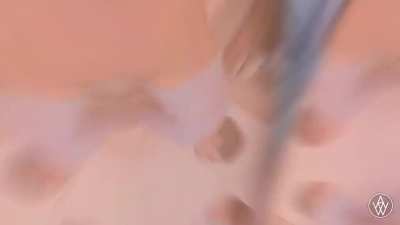 POV Anal