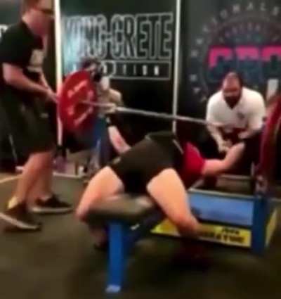 Woman&rsquo;s arm fails on bench press