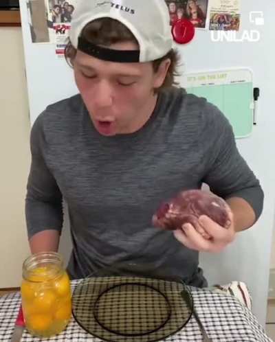 &lsquo;Raw Carnivore&rsquo;&hellip; 🤮