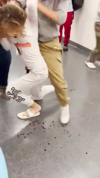 You leaking bruh