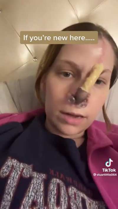 What snorting up to an ounce of cocaine a day can do&hellip;