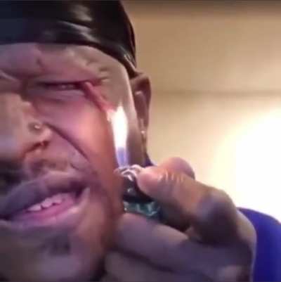And that&rsquo;s how I lost my bloody eye.
