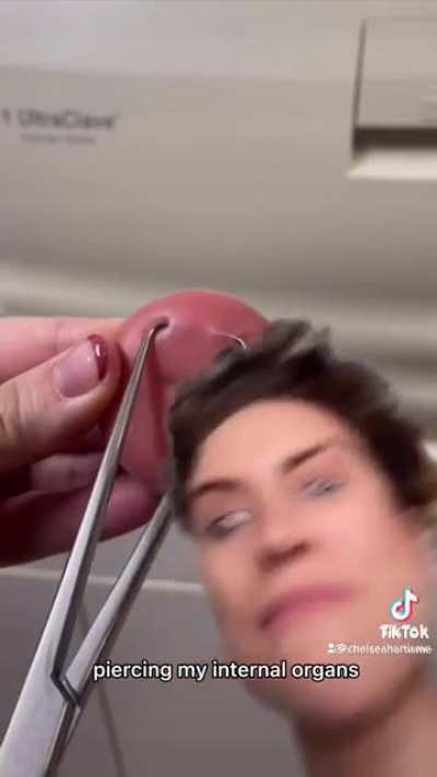 IUD insertion is barbaric. Please join the campaign for adequate pain management during painful procedures instead of telling women it&rsquo;s &ldquo;just a pinch&rdquo;