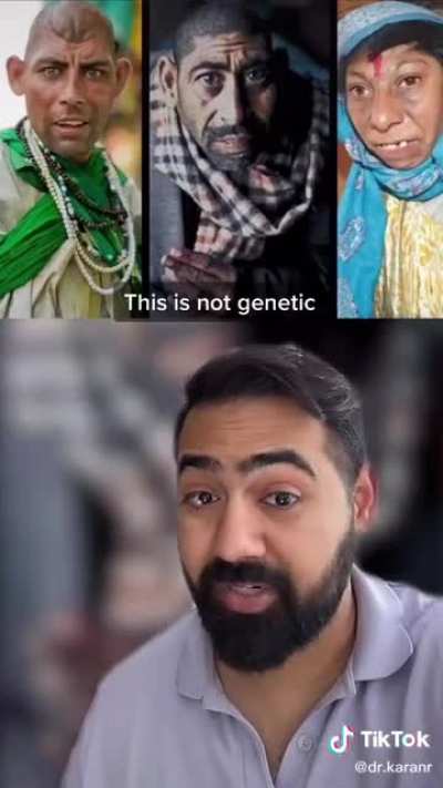 The rat children in Pakistan. I hope it's not true...