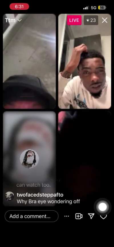 3100 lazy eye dre