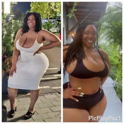 Some times they don’t even need a bbl. Just lipo 360 and a tummy tuck 😍