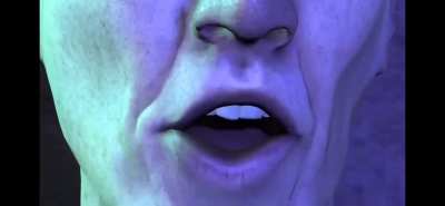 Pain