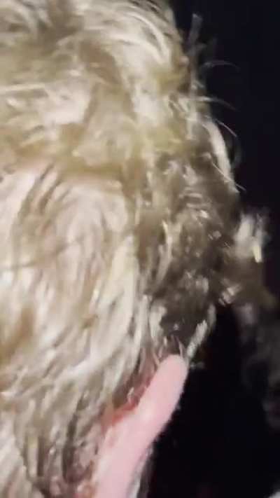 Clip from yesterday