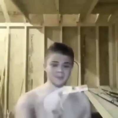 Dude did it hurt?