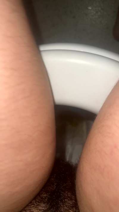 My friend says I pee "weirdly" and I wanted to know what the experts think.
