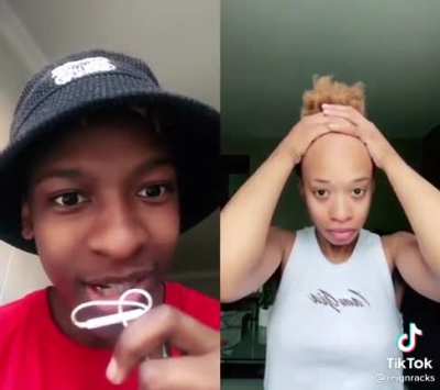 Damn nice forehead