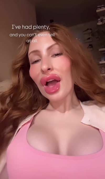 TikTok "botched" filter supposed to be funny; instead SurgeryWorld's favorite look