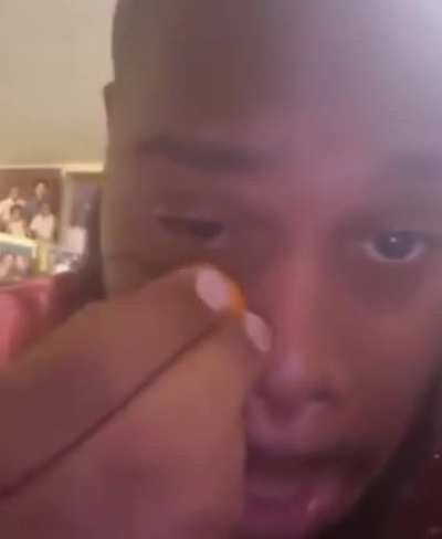 To get rid of under eye bags.