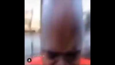 foehead