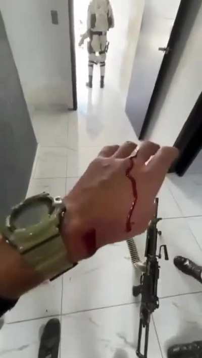 [LFO] Special Forces Soldier Who Helped Take Down El Mencho Shows Off Bullet Embedded in His Chin 🇲🇽 (Blood Warning)