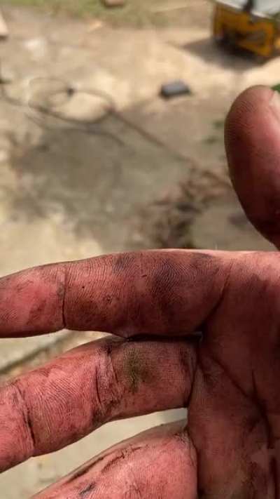 A splinter went through my finger into the other stitching them together.