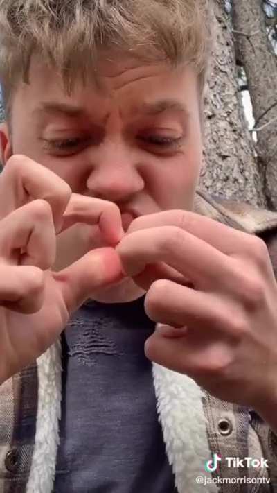 Pistachios