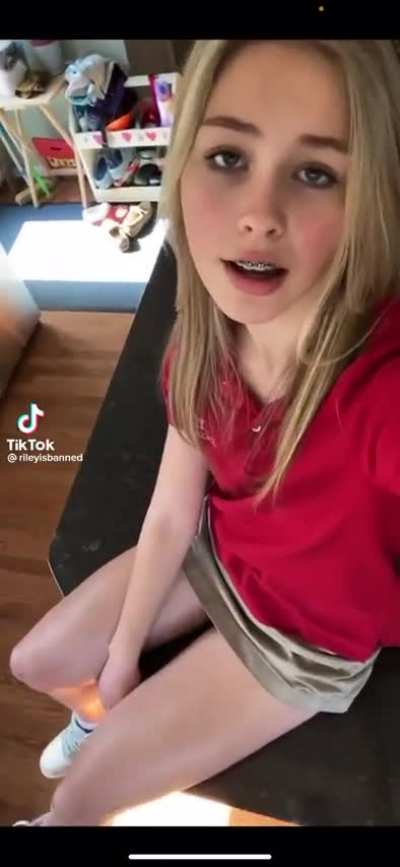 Legs