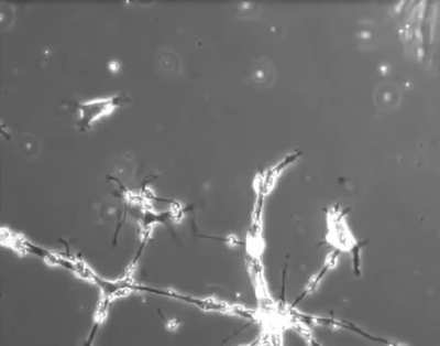 C&eacute;lulas cerebrais em um prato de cultura tentando formar conex&otilde;es entre si