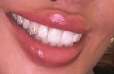 Glossy lips