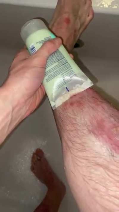 You guys hated this the last time, you&rsquo;ll definitely still hate it this time. Now with more skin-cheese :)