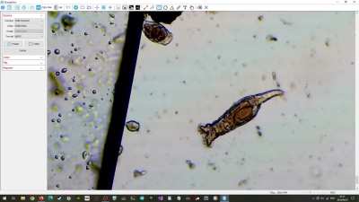 Look at them having fun. Still learning how to read and use my microscope(x1000).