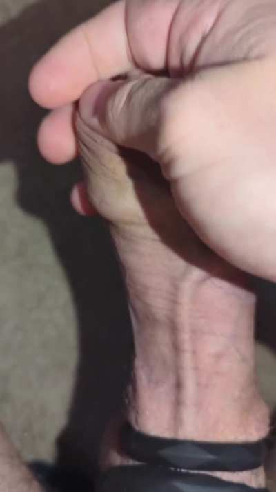 my foreskin gets so tight as I get hard 😩