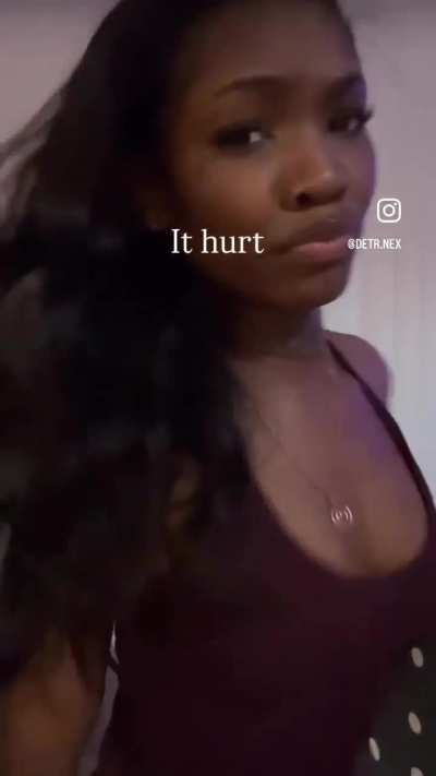 😵&zwj;💫🥴
