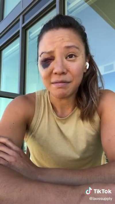 An innocent woman who was attacked while out walking her dog shares the story of the traumatic encounter