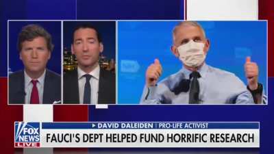 Dr Fauci&rsquo;s NIAID purchased severed heads of aborted babies and grafted their scalps onto lab rats