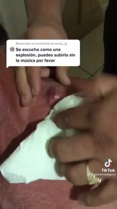 Sounds like an unwanted facial to me