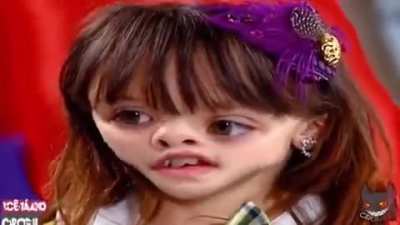 Explana n cilindro