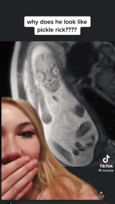 Baby MRIs a.k.a. Nightmare Demons