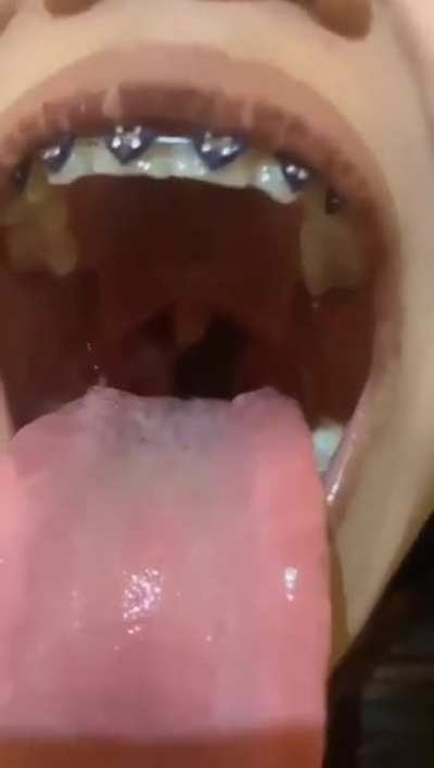 gummy
