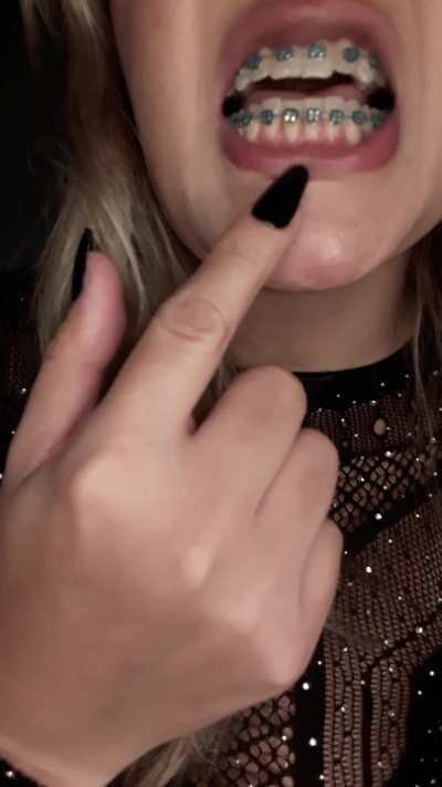ready to bite you