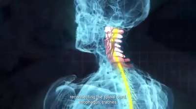 This video is too much in talks. This is a presentation video of a potential future medical robot and surgical procedure that will transplant entire heads using AI and robotics. We only need to grow human bodies, and keep transplanting our heads to new yo