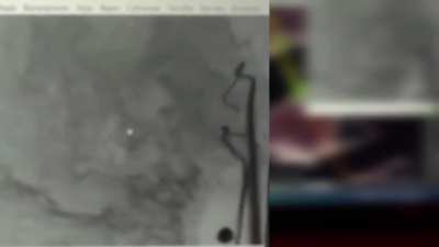Russian boat full of infantry hits a Ukrainian anti-landing mine "YaRM" which was installed by drone operators of the 123rd TD Brigade (Kherson region)